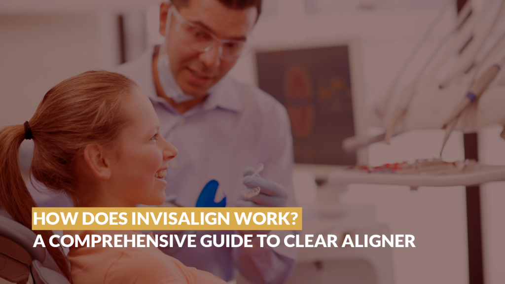 How Does Invisalign Work? Complete Guide - Sherman Oaks Smile Studio