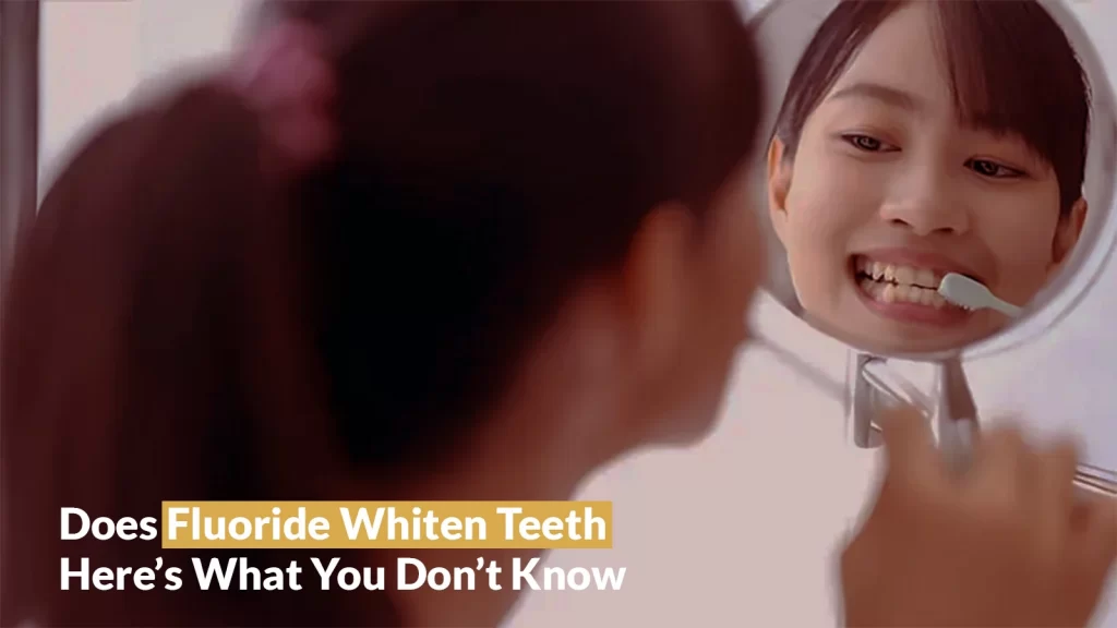 Does Fluoride Whiten Teeth Here’s What You Don’t Know