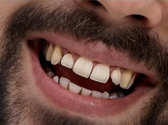 cosmetics DentisryBefore
