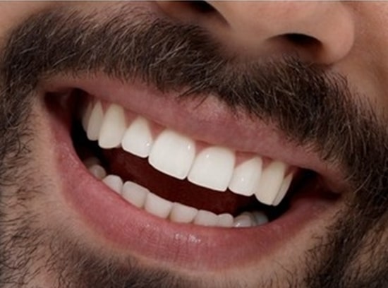 cosmetics Dentisryafter