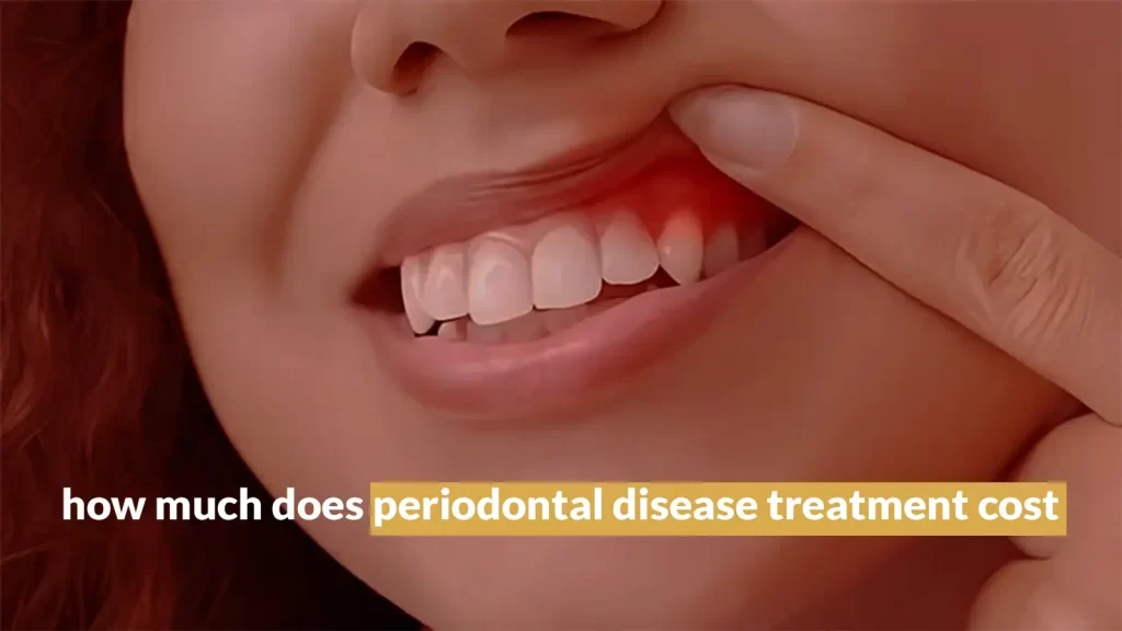 HOW MUCH DOES PERIODONTAL DISEASE TREATMENT COST - Sherman Oak Smile Studio