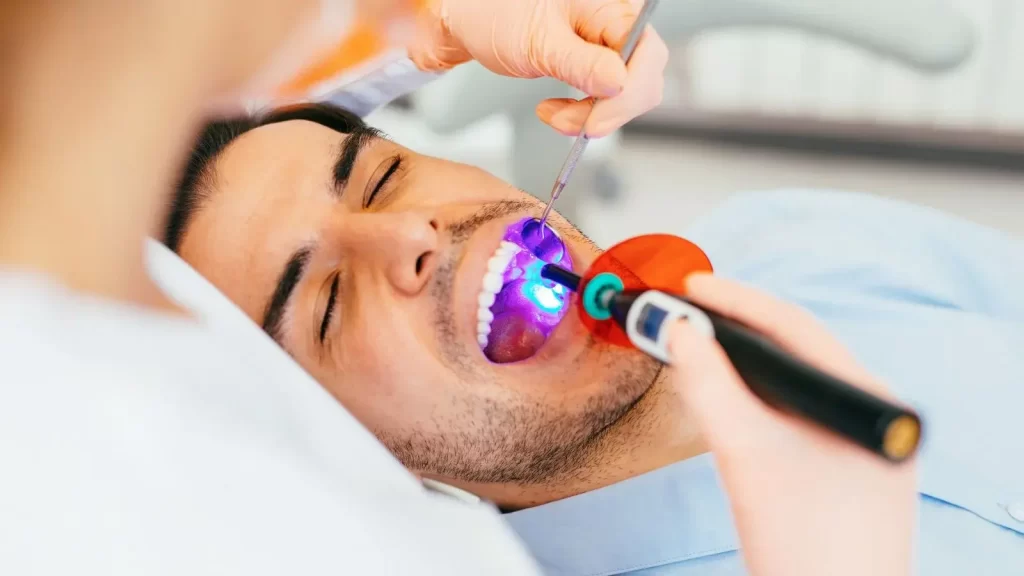 Dental Sealants - Dentist Sherman Oaks Smile Studio, CA