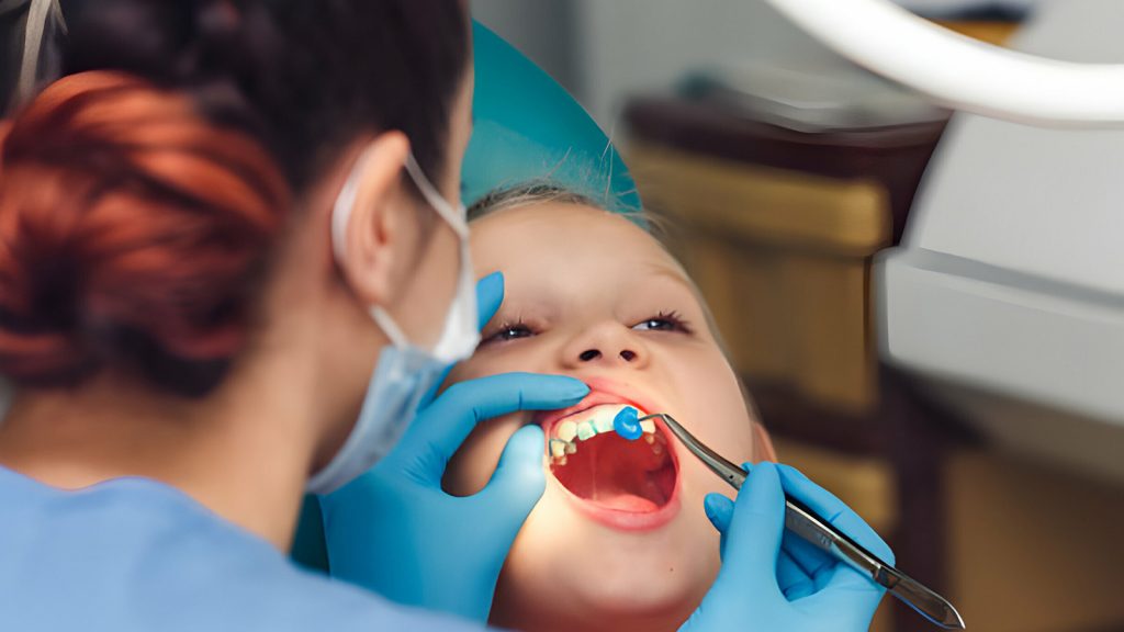 WHAT DOES A CAVITY LOOK LIKE? - Sherman Oaks Smile Studio