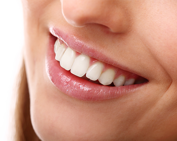 Teeth Whitening