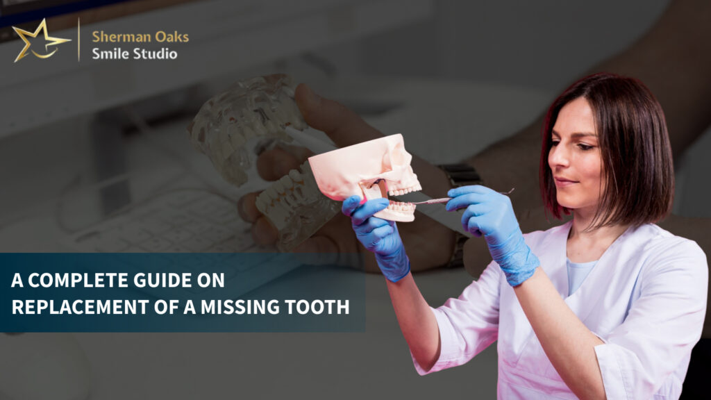 Guide on Replacement of a Missing Tooth