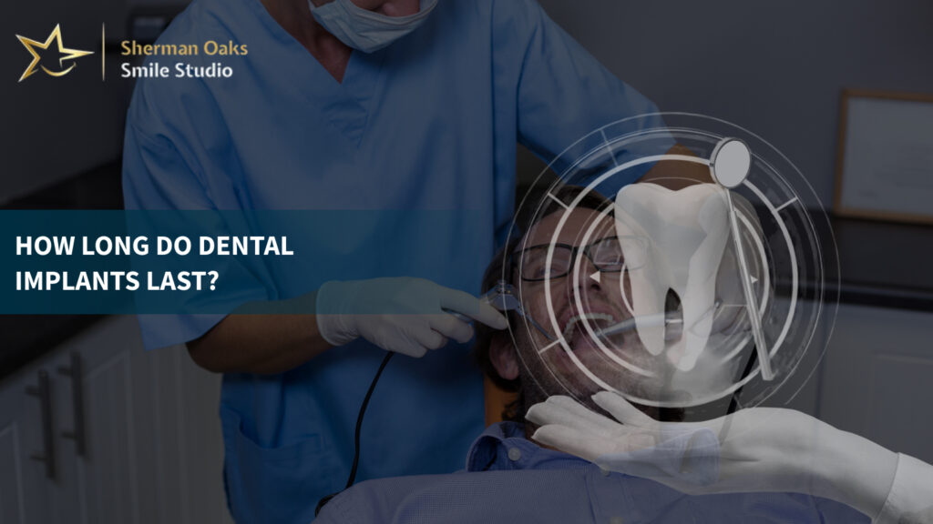 Dental Implants Last