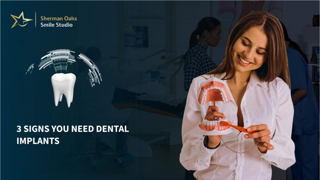 Need Dental Implants