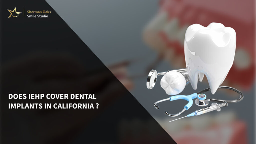 Does IEHP cover dental