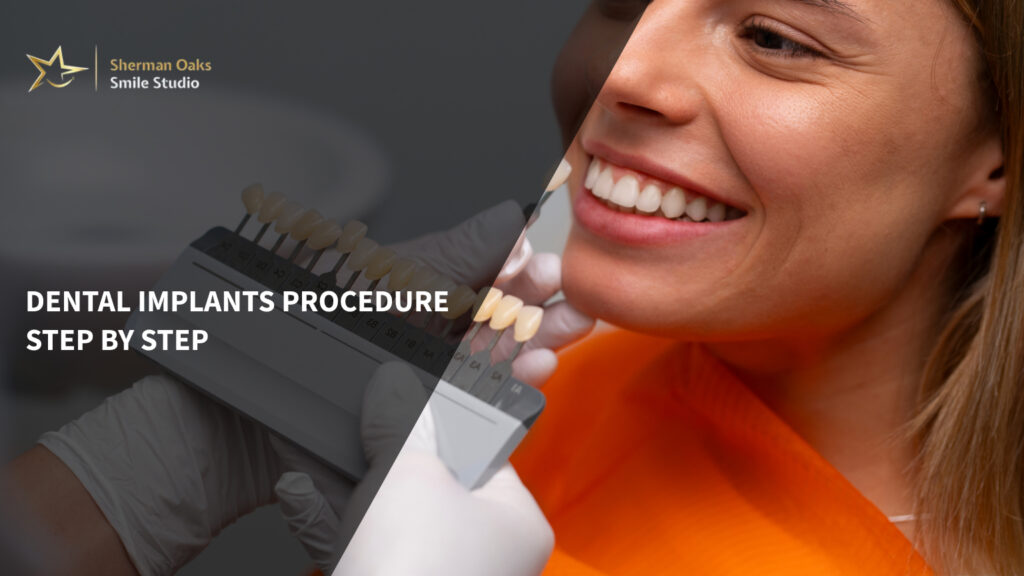 Dental Implants Procedure