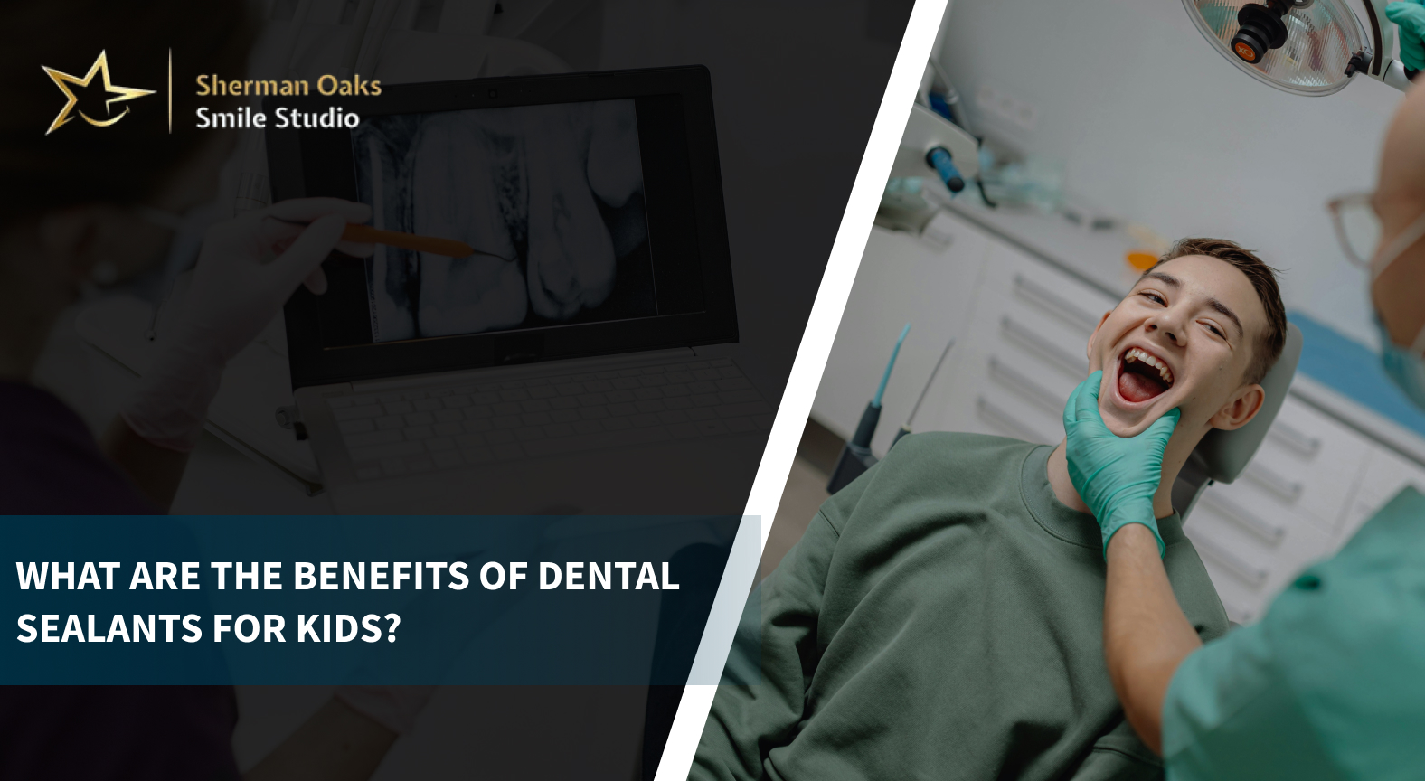 What Are the Benefits of Dental Sealants for Kids?
