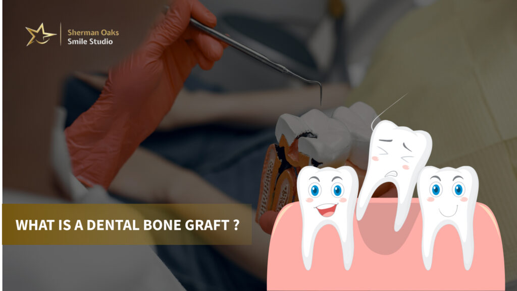 Dental Bone Graft