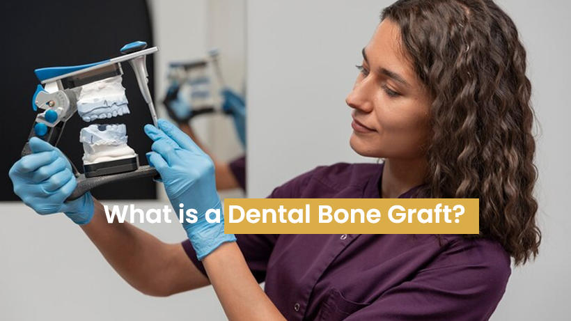 What is a Dental Bone Graft