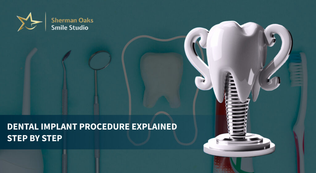 Dental Implant Procedure Explained Step by Step