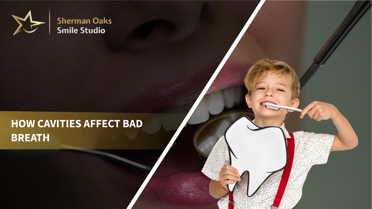 How Cavities Affect Bad Breath: Tips by Dentist