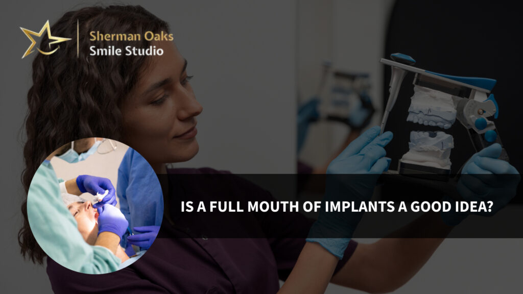 Mouth of Implants