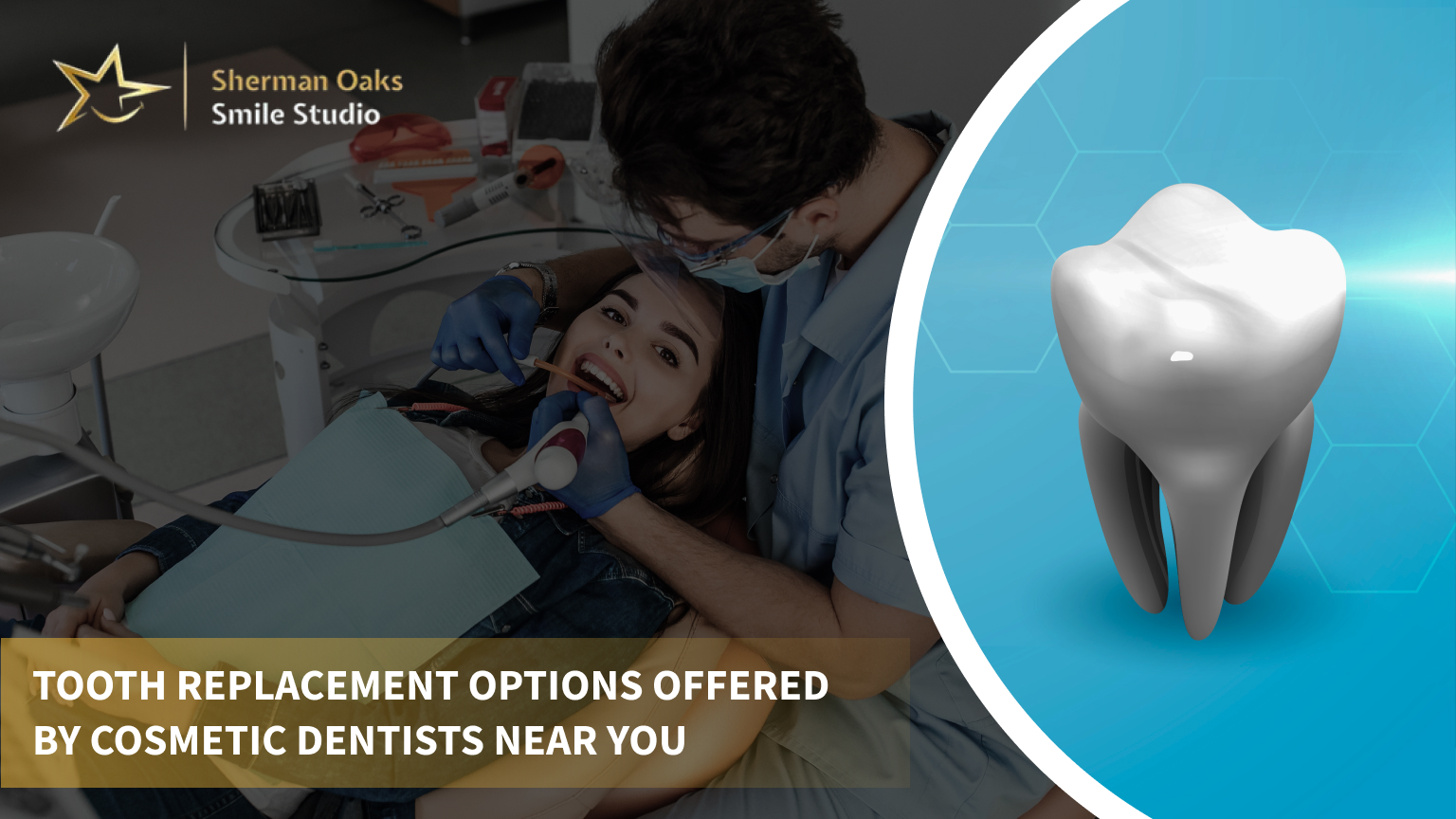 Top 5 Tooth Replacement Options Offered by Cosmetic Dentists Near You