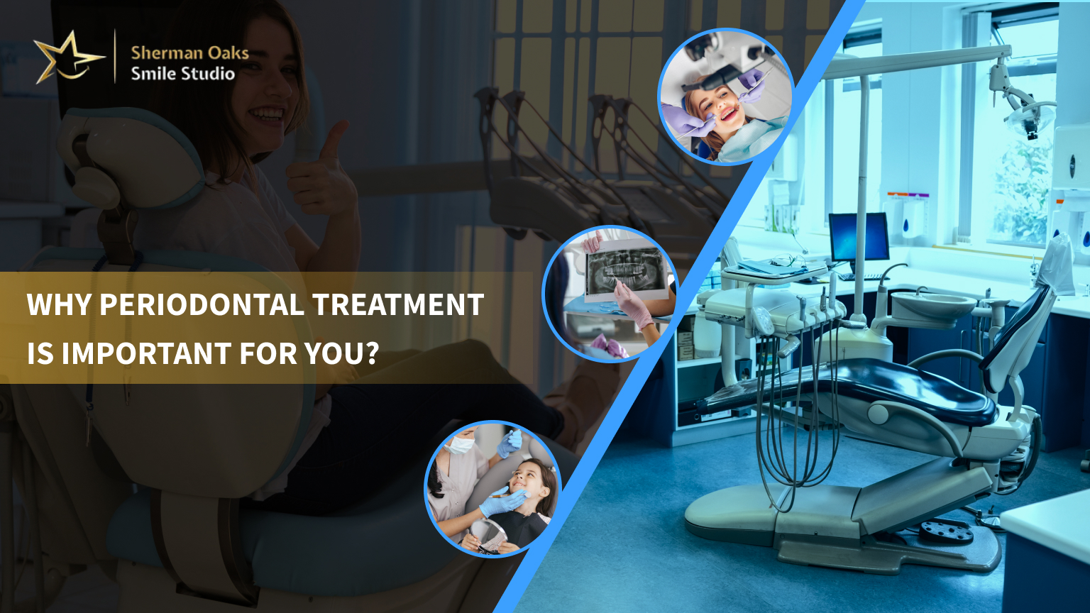 Why Periodontal Treatment Is Important for You?