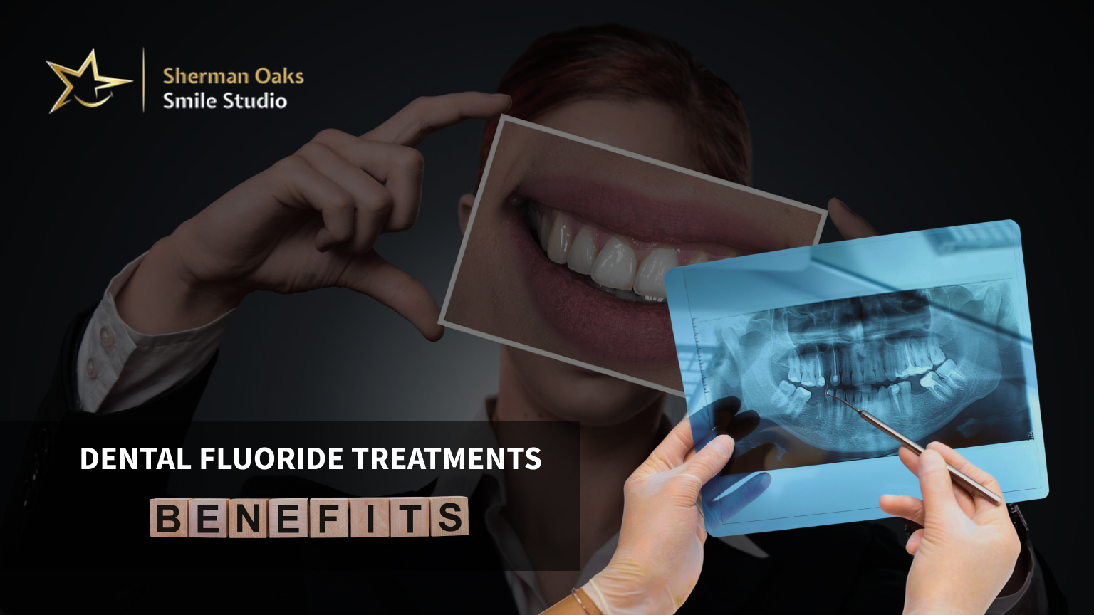 Dental Fluoride Treatments in Los Angeles