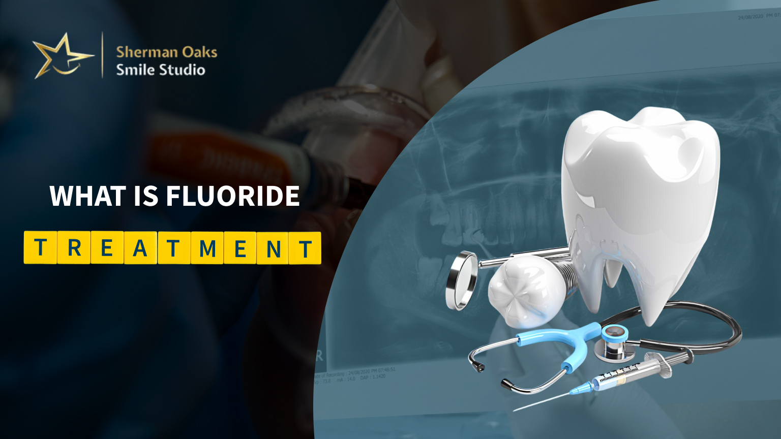 Fluoride Treatment