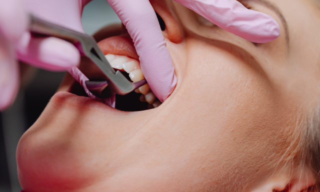 Pediatrics Dentist Sherman Oaks