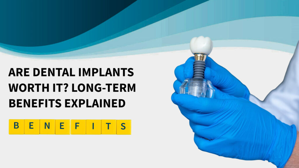 Cosmetic dental implants
