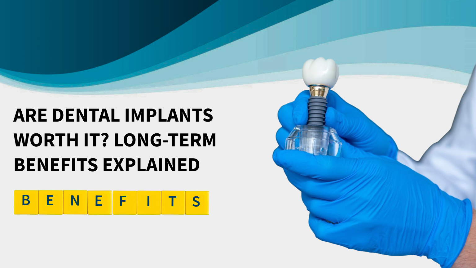 Are Dental Implants Worth It? Long-Term Benefits Explained