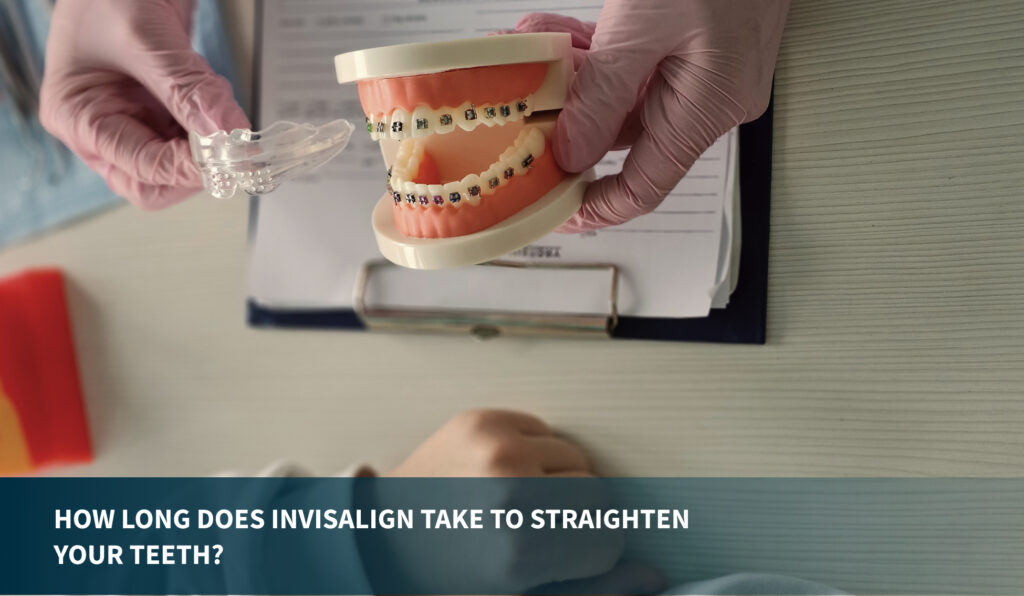 Invisalign in Sherman Oaks