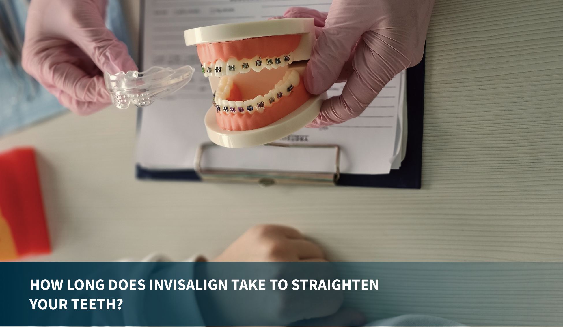 How Long Does Invisalign Take to Straighten Your Teeth?