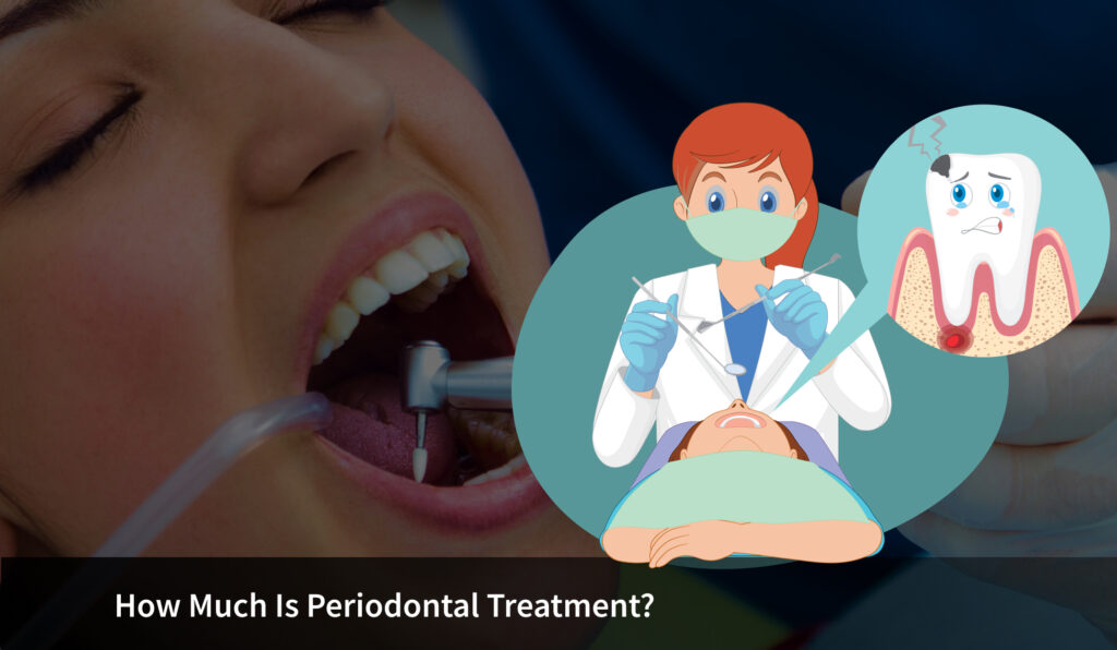 Periodontal Treatment