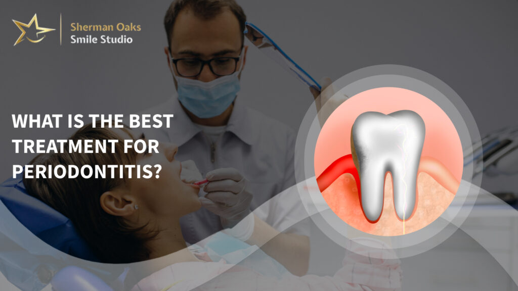 Periodontitis treatment