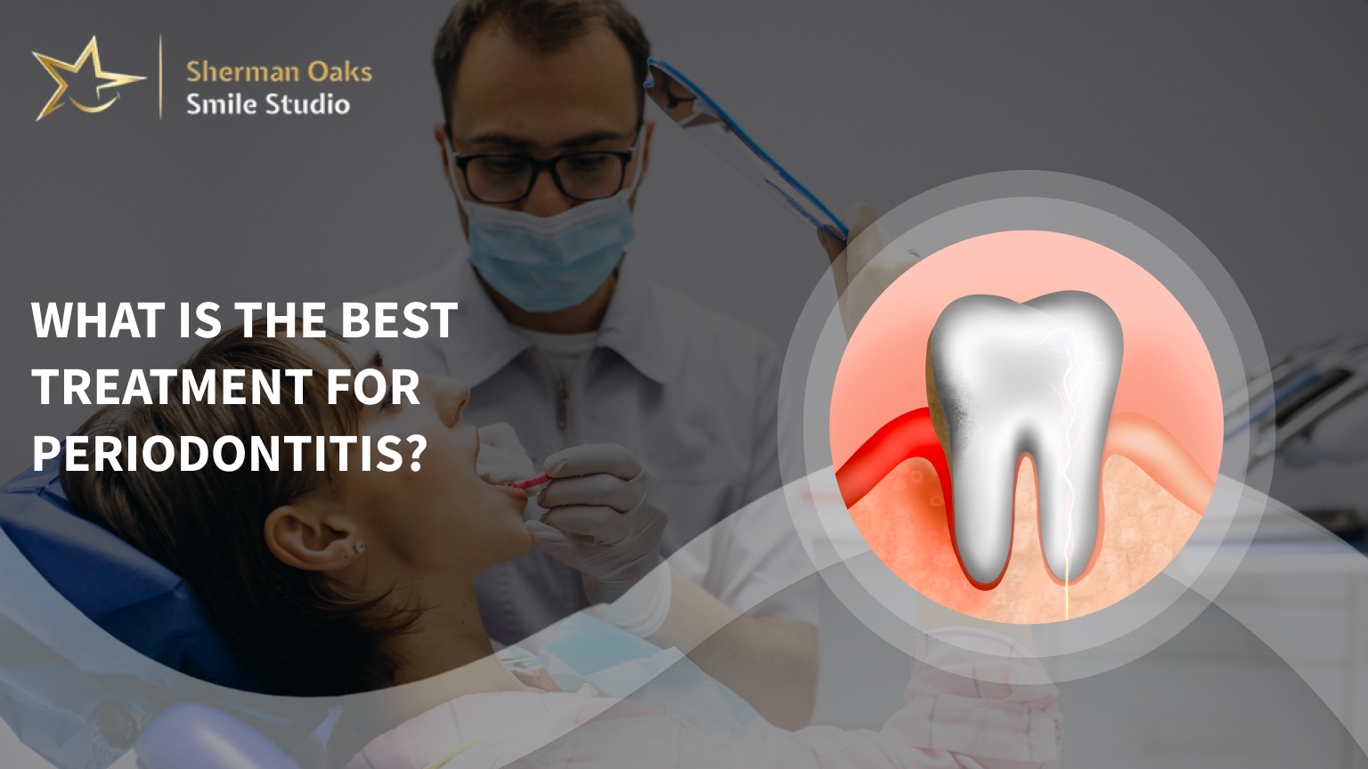 What is the best treatment for periodontitis?