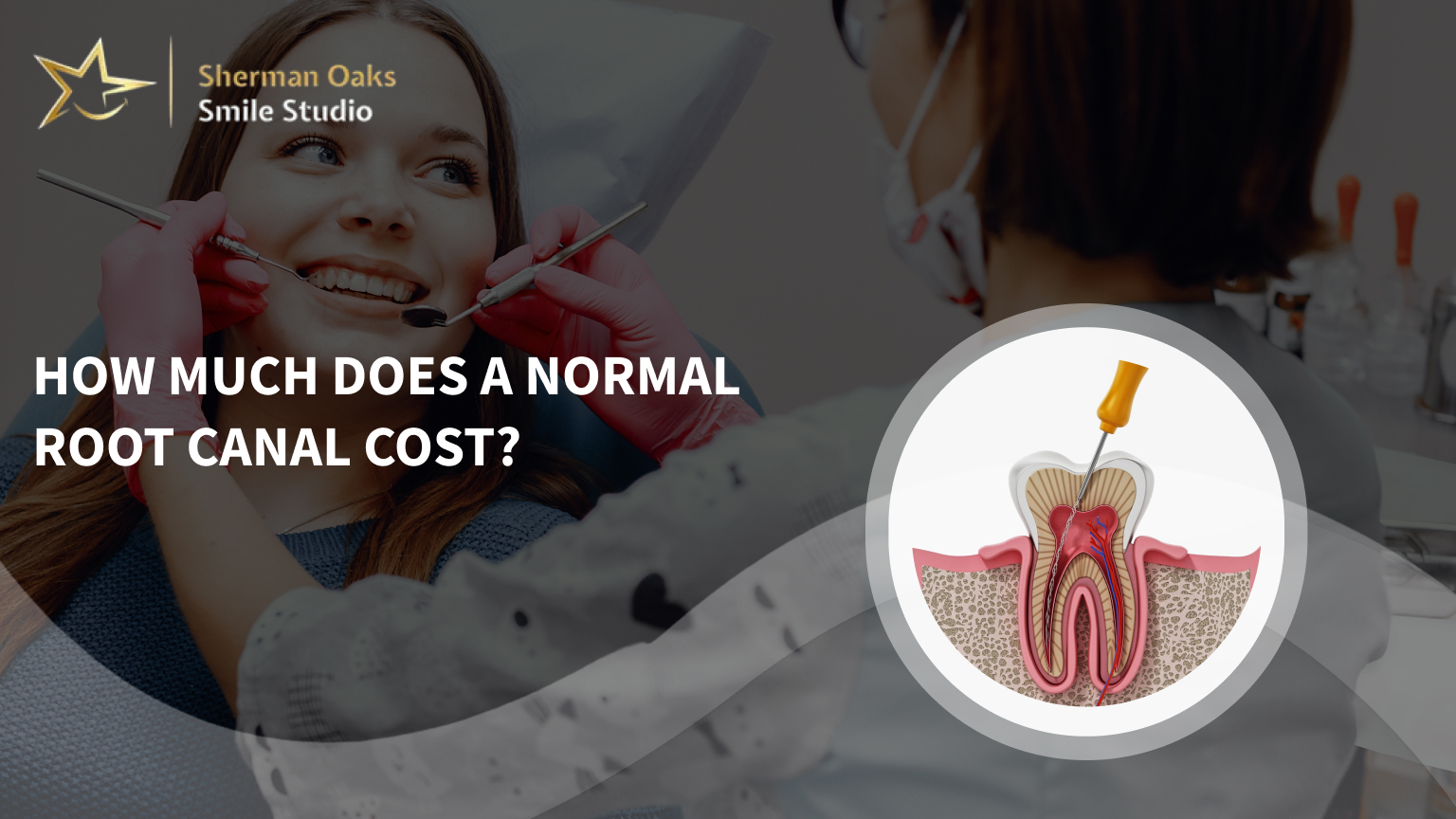 How much does a normal root canal cost?