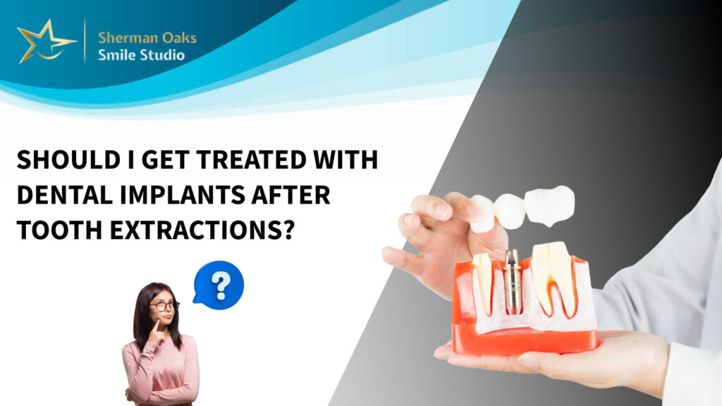 Dental implants Reseda CA