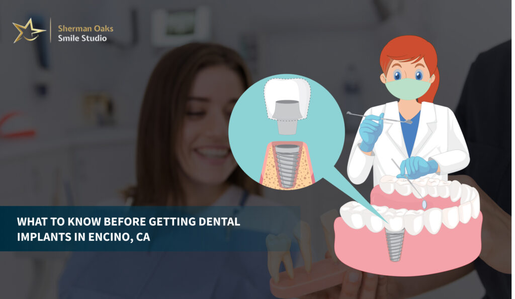 dental implants encino ca1