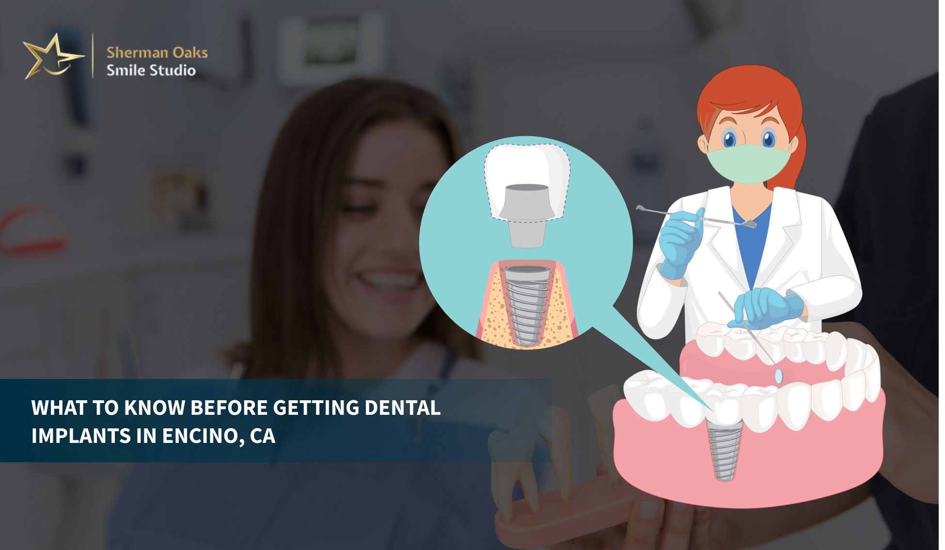 What to Know Before Getting Dental Implants in Encino, CA