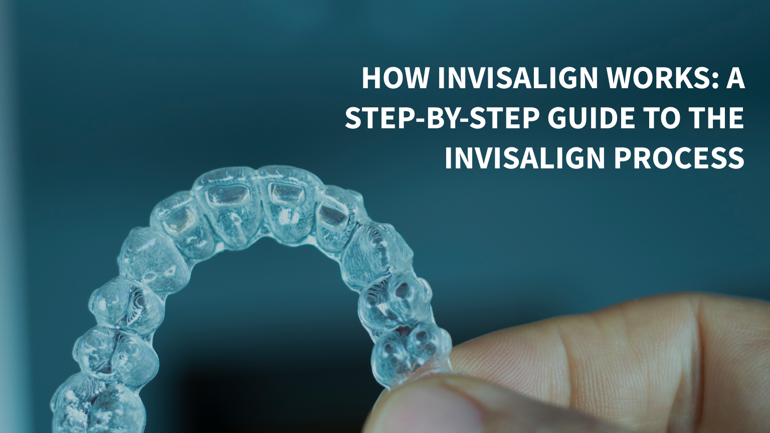 How Invisalign Works: A Step-By-Step Guide to the Invisalign Process
