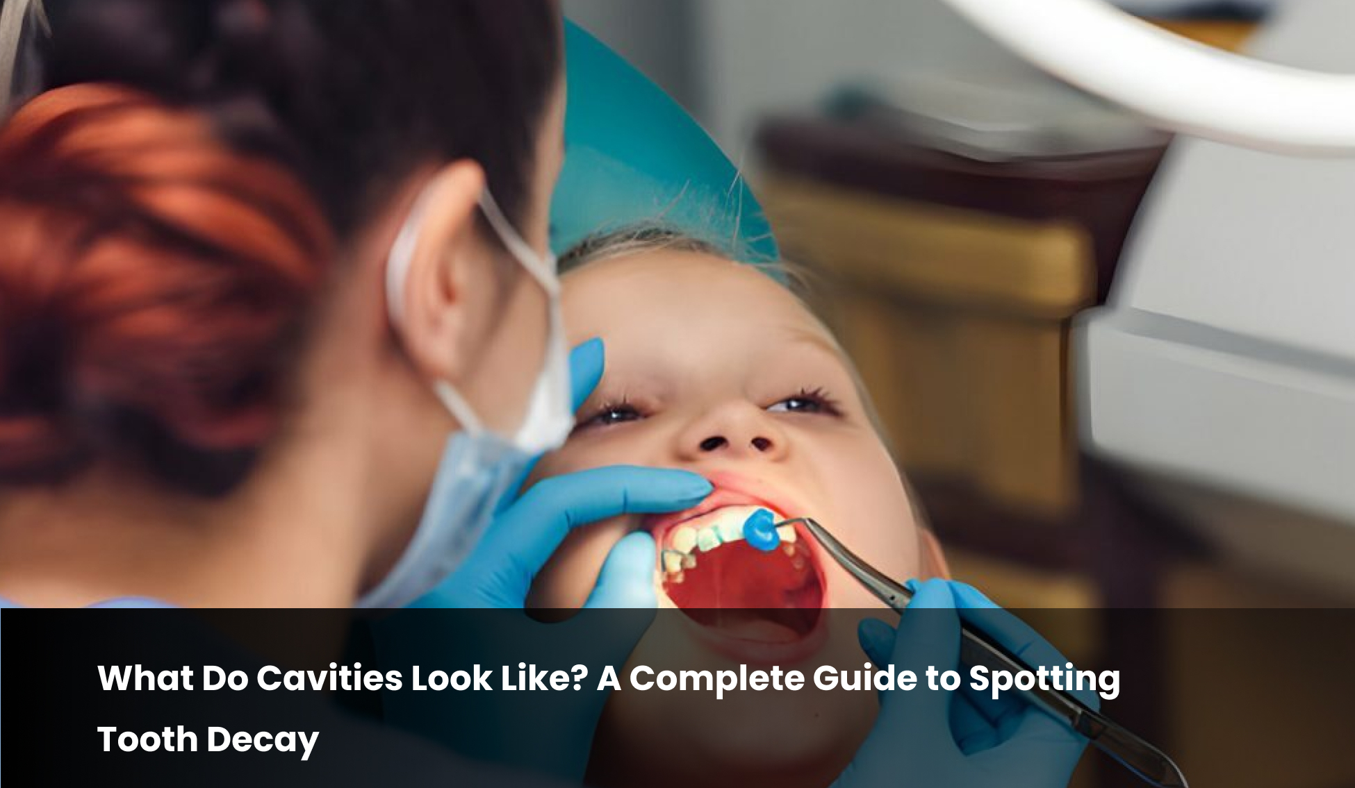 What Do Cavities Look Like? A Complete Guide to Spotting Tooth Decay