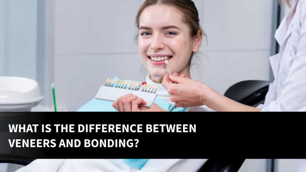 What Is the Difference Between Veneers and Bonding